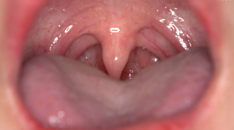 【美少女】「【歯・口腔フェチ】新人女優相楽さゆなちゃんの口内観察＆巨大女フェチ」わかしラボWAKA-078 相楽さゆな 9❤アドア｜h_1416ad02007